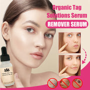 Organic Tags Solutions Serum No Trace Painle Skin Tag Remover Serum Mole Removal Cream Painless Face Wart Mole Freckle